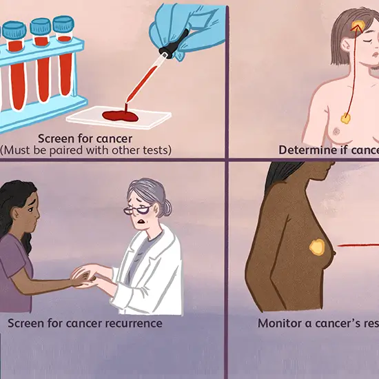 breast metastatic marker test